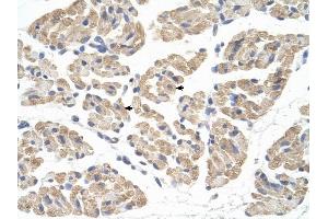FARS2 antibody was used for immunohistochemistry at a concentration of 4-8 ug/ml to stain Skeletal muscle cells (arrows) in Human Muscle. (FARS2 抗体  (N-Term))