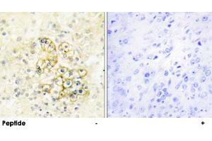 Immunohistochemistry analysis of paraffin-embedded human prostate tissue using PMEPA1 polyclonal antibody . (PMEPA1 抗体)