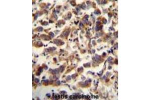 Immunohistochemistry (IHC) image for anti-Transcription Factor A, Mitochondrial (TFAM) antibody (ABIN5015230) (TFAM 抗体)