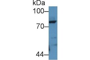 Detection of POSTN in Rat Lung lysate using Polyclonal Antibody to Periostin (POSTN) (Periostin 抗体  (AA 24-173))