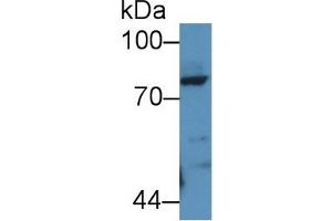 Detection of POSTN in Rat Lung lysate using Polyclonal Antibody to Periostin (POSTN) (Periostin 抗体  (AA 24-173))