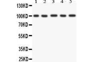 Anti- FGFR4 antibody, Western blotting All lanes: Anti FGFR4  at 0. (FGFR4 抗体  (AA 22-206))