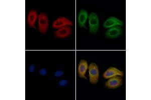 ABIN6261698 and ABIN6276856 staining Hela cells by IF/ICC.