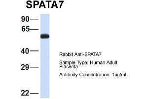 Western Blotting (WB) image for anti-Spermatogenesis Associated 7 (SPATA7) (Middle Region) antibody (ABIN2787132)