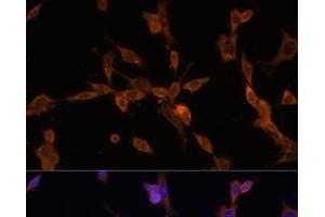Immunofluorescence analysis of NIH/3T3 cells using UBE2J1 Polyclonal Antibody at dilution of 1:100. (UBE2J1 抗体)