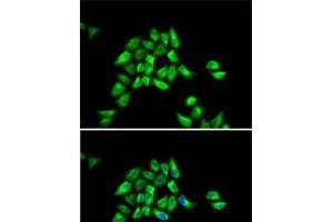 Immunofluorescence analysis of HeLa cells using DCTN1 Polyclonal Antibody (Dynactin 1 抗体)