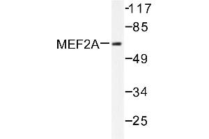 Image no. 1 for anti-Myocyte Enhancer Factor 2A (MEF2A) antibody (ABIN265517) (MEF2A 抗体)