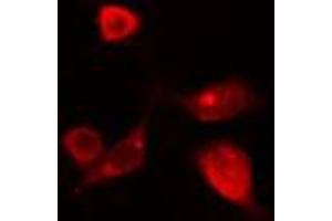 ABIN6274118 staining HT29 cells by IF/ICC. (T-Box 10 抗体  (Internal Region))