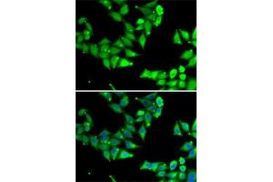 Immunofluorescence analysis of U2OS cells using OGFR Rabbit pAb (ABIN6128395, ABIN6145006, ABIN6145007 and ABIN6222871) at dilution of 1:50 (40x lens). (OGFR 抗体  (AA 1-280))