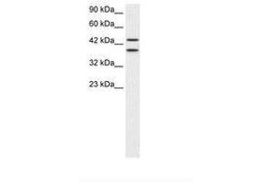 Image no. 1 for anti-Zinc Finger Protein 839 (ZNF839) (AA 530-579) antibody (ABIN202500) (ZNF839 抗体  (AA 530-579))