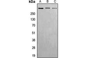 Western blot analysis of ATM (pS1981) expression in Hela (A), Raw264. (ATM 抗体  (pSer1981))
