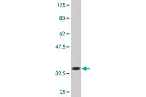 Western Blot detection against Immunogen (34. (LZTFL1 抗体  (AA 39-120))