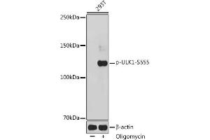 Western blot analysis of extracts of 293T cells, using Phospho-ULK1-S555 antibody (ABIN6135333, ABIN6136282, ABIN6136283 and ABIN6225654) at 1:1000 dilution. (ULK1 抗体  (pSer555))