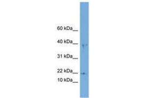 Image no. 1 for anti-Actin Related Protein 2/3 Complex, Subunit 3, 21kDa (ARPC3) (AA 71-120) antibody (ABIN6744931)