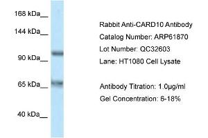 Western Blotting (WB) image for anti-Caspase Recruitment Domain Family, Member 10 (CARD10) (C-Term) antibody (ABIN970291) (CARD10 抗体  (C-Term))