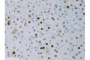 Immunohistochemistry (Paraffin-embedded Sections) (IHC (p)) image for anti-Proliferating Cell Nuclear Antigen (PCNA) (AA 1-261) antibody (ABIN3020826)