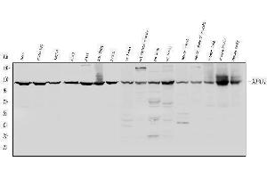 Western blot analysis of CRM1 using anti-CRM1 antibody (ABIN4886771).