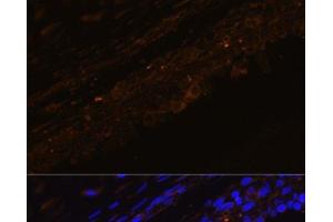 Immunofluorescence analysis of Rat bronchus cells using KRT7 Polyclonal Antibody at dilution of 1:100. (Cytokeratin 7 抗体)