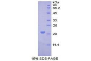 SDS-PAGE analysis of Human COL8A1 Protein. (COL8A1 蛋白)