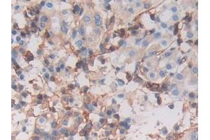 Detection of MHCC in Human Stomach Tissue using Polyclonal Antibody to Major Histocompatibility Complex Class I C (MHCC) (MHCC (AA 48-305) 抗体)