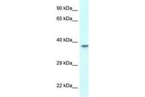 Image no. 1 for anti-Uroplakin 3B (UPK3B) (AA 247-296) antibody (ABIN6747778) (Uroplakin 3B 抗体  (AA 247-296))
