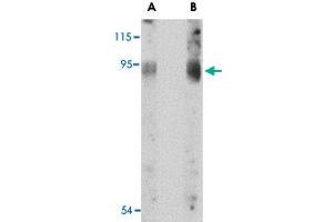 Western blot analysis of BICD2 in A-549 cell lysate with BICD2 polyclonal antibody  at (A) 1 and (B) 2 ug/mL . (BICD2 抗体  (C-Term))