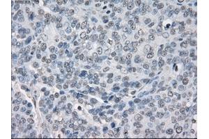 Immunohistochemical staining of paraffin-embedded Kidney tissue using anti-PPP5Cmouse monoclonal antibody. (PP5 抗体)