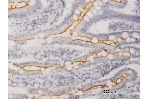 Immunoperoxidase of purified MaxPab antibody to WISP1 on formalin-fixed paraffin-embedded human small Intestine. (WISP1 抗体  (AA 1-280))