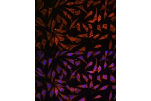Immunofluorescence analysis of L929 cells using RPS8 antibody (ABIN7270041) at dilution of 1:100. (RPS8 抗体)