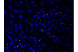 ABIN6266515 at 1/200 staining human liver tissue cells by ICC/IF. (COL2A1 抗体  (N-Term))