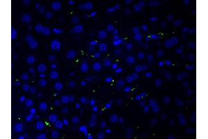Immunofluorescence (fixed cells) (IF/ICC) image for anti-Collagen, Type II, alpha 1 (COL2A1) (N-Term) antibody (ABIN6260939)