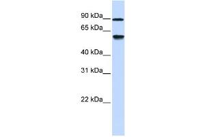 Western Blotting (WB) image for anti-Alcohol Dehydrogenase, Iron Containing, 1 (ADHFE1) antibody (ABIN2459564) (ADHFE1 抗体)