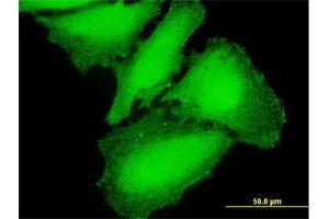 Immunofluorescence of purified MaxPab antibody to CAMK2G on HeLa cell. (CAMKII gamma 抗体  (AA 1-527))
