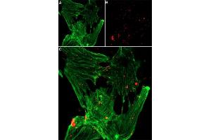 Live cell imaging of ATX-II-ATTO Fluor-647N in neonatal mouse cardiomyocytes. (ATX-II peptide (Atto 647N))
