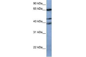 Western Blot showing ZNF681 antibody used at a concentration of 1-2 ug/ml to detect its target protein. (ZNF681 抗体  (N-Term))
