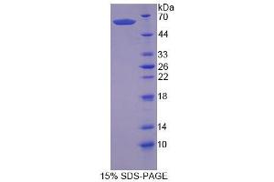 SDS-PAGE analysis of Human SCRN1 Protein. (Secernin 1 Protein (SCRN1))