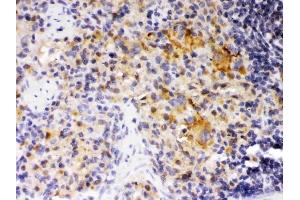 IHC analysis of SKAP55 using anti-SKAP55 antibody (ABIN3044545). (SKAP1 抗体  (Middle Region))