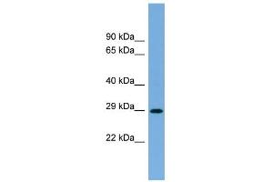 WB Suggested Anti-RAB40C Antibody Titration: 0. (RAB40C 抗体  (N-Term))