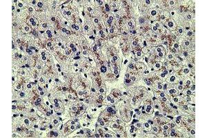 Immunohistochemical staining of paraffin-embedded Human liver tissue using anti-AFP mouse monoclonal antibody. (alpha Fetoprotein 抗体)