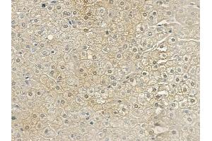 ABIN6261513 and ABIN6269183 at 1/100 staining human normal liver tissue by IHC-P. (ELK1 抗体  (C-Term))