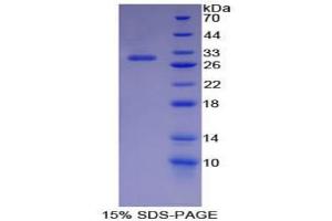 SDS-PAGE analysis of Mouse IKBIP Protein. (IKbIP 蛋白)