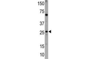Western Blotting (WB) image for anti-BCL2/adenovirus E1B 19kDa Interacting Protein 1 (BNIP1) (BH3 Domain) antibody (ABIN2997180)