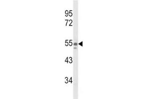 Western blot analysis of NAMPT antibody and A375 lysate (NAMPT 抗体  (AA 400-426))