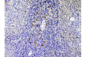 IHC analysis of IL12B using anti-IL12B antibody . (IL12B 抗体  (AA 23-250))