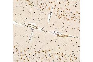 Immunohistochemistry (Paraffin-embedded Sections) (IHC (p)) image for anti-Notch 3 (NOTCH3) antibody (ABIN7074862)