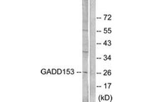 Western blot analysis of extracts from LOVO cells, treated with serum 10% 15', using GADD153 Antibody. (DDIT3 抗体  (AA 91-140))