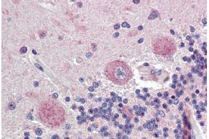 Brain, cerebellum, Human: Formalin-Fixed, Paraffin-Embedded (FFPE) (Fatty Acid Synthase 抗体  (AA 2118-2129))