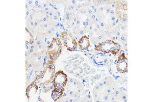 Immunohistochemistry (IHC) image for anti-Transmembrane Emp24 Protein Transport Domain Containing 3 (TMED3) (AA 24-180) antibody (ABIN7270944)
