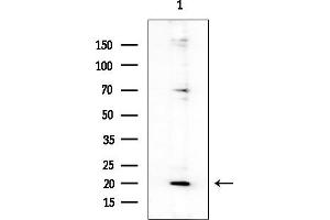 Western blot analysis of lysates from COLO205 cells(heat-shock treatment), using AVP Antibody at 1/1000 dilution.
