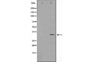 Western blot analysis on Jurkat cell lysate using Cyclin G Antibody,The lane on the left is treated with the antigen-specific peptide. (Cyclin G1 抗体  (Internal Region))